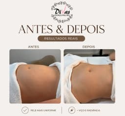 Drenagem Linfática manual com manta detox