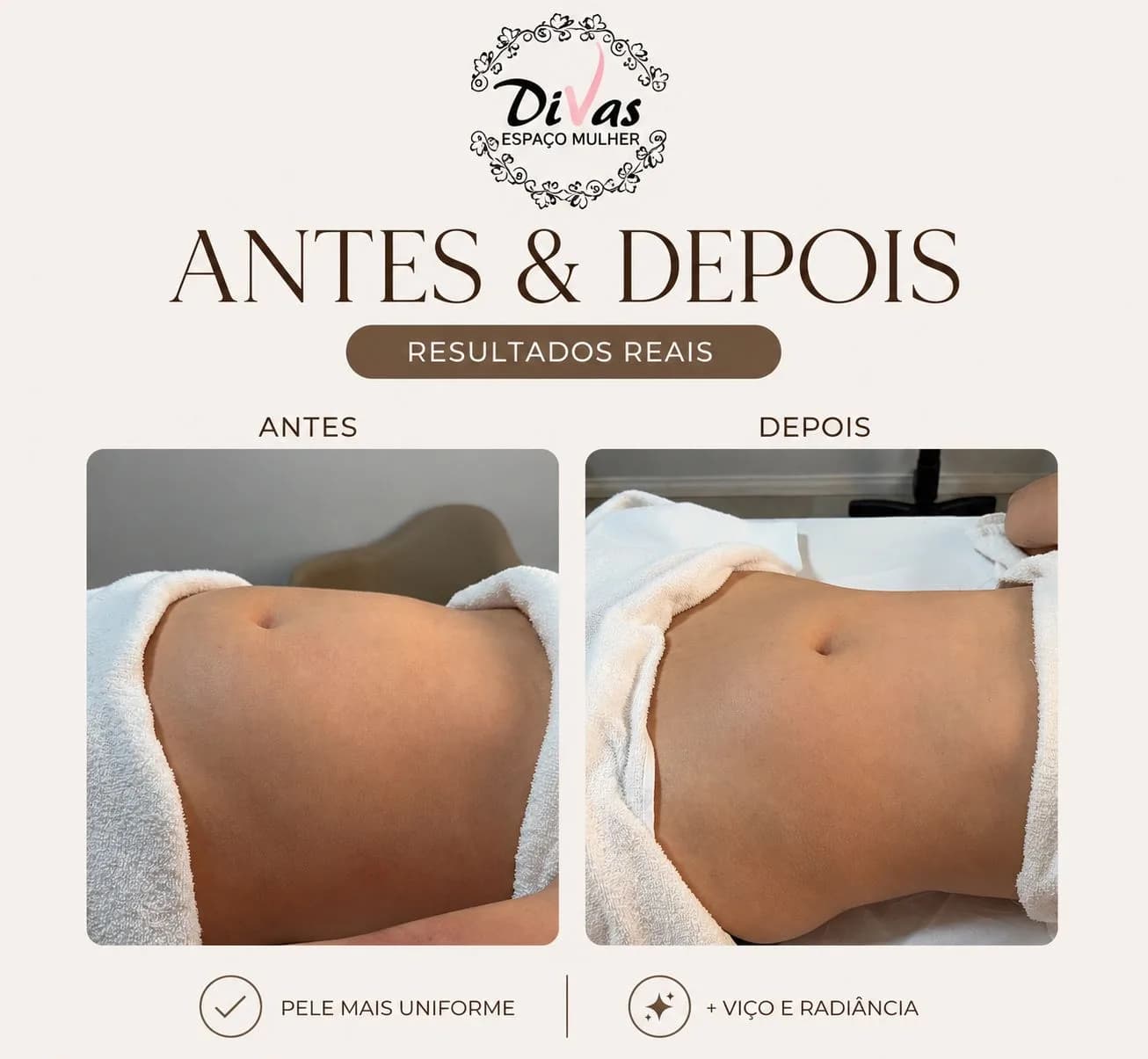 Drenagem Linfática manual com manta detox