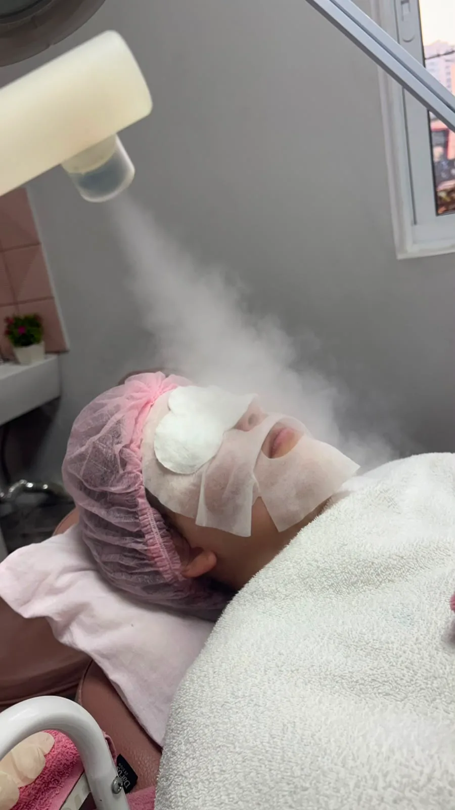 Limpeza de pele com peeling de diamante.